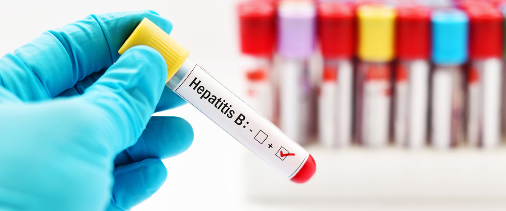 Wat is hepatitis B? Wat binne de symptomen en behanneling metoaden?